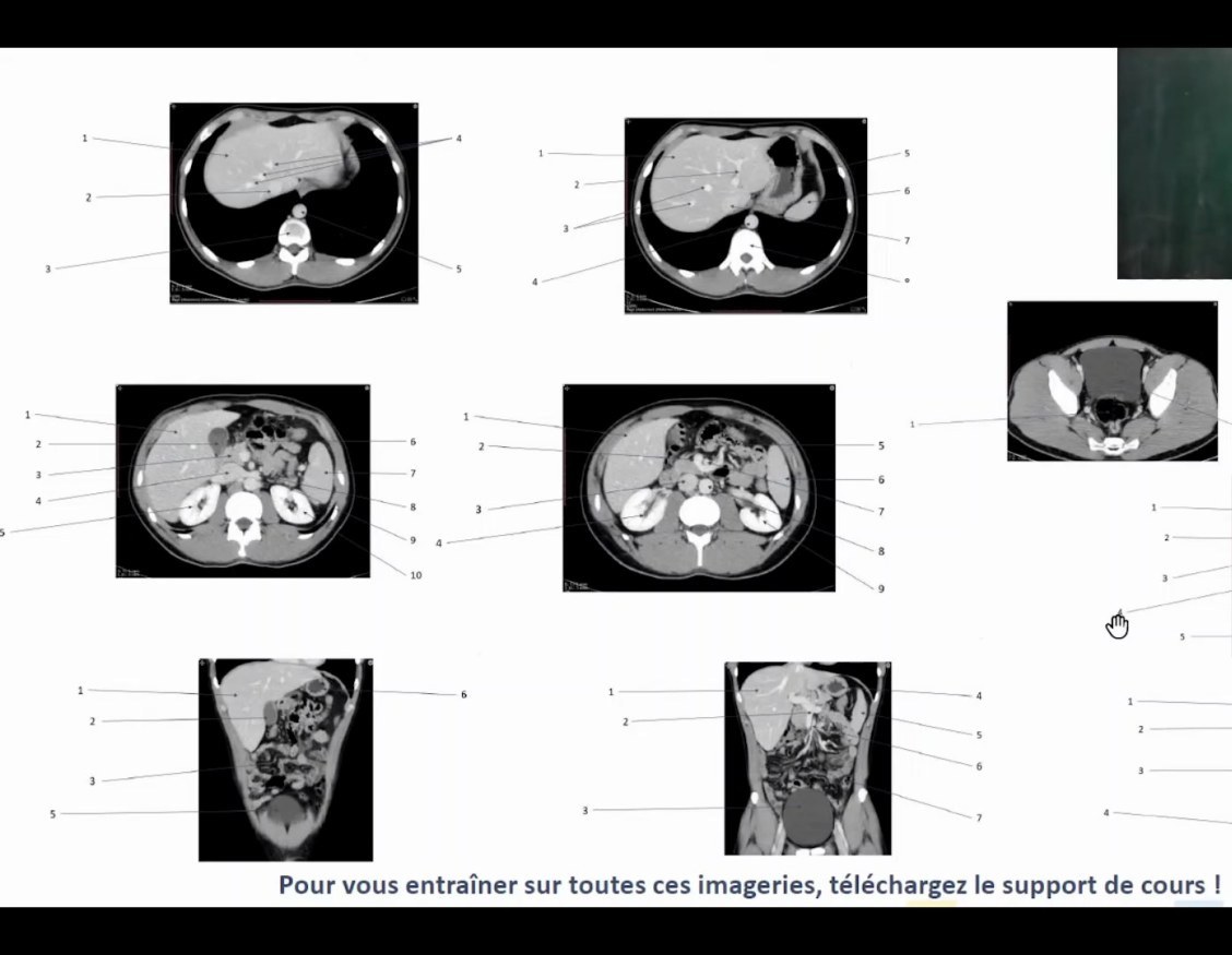 Scanner abdominal avec temps d'injection