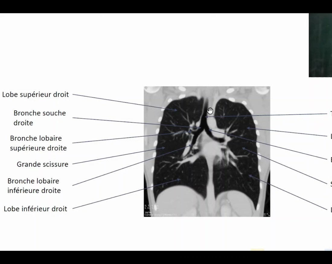 Radiographie avec lignes et repères