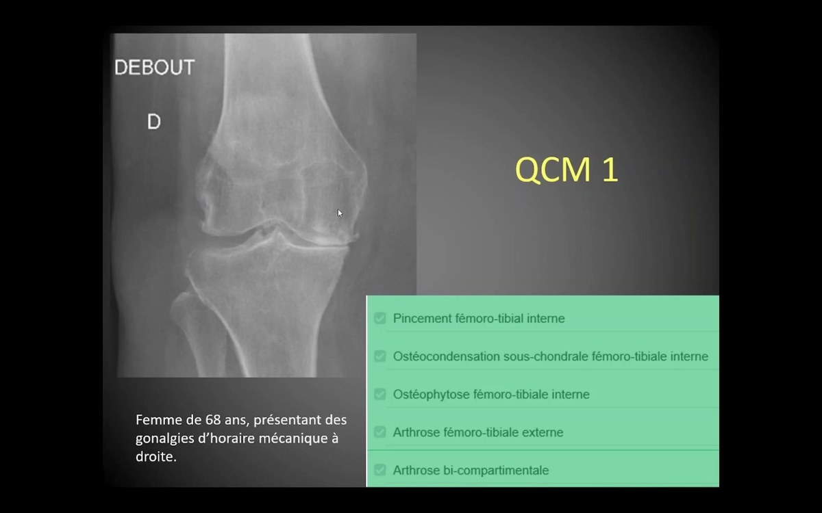 QCM ostéo-articulaire de depart