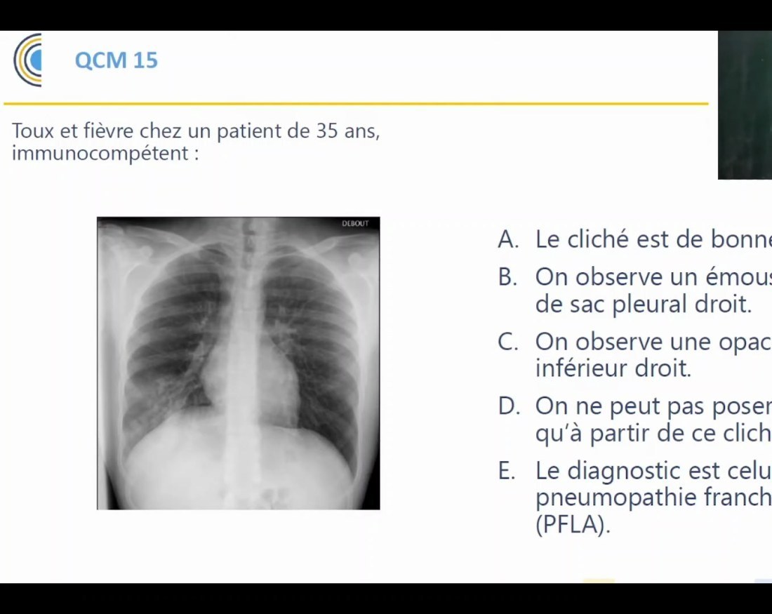 Radiographie thoracique de cas