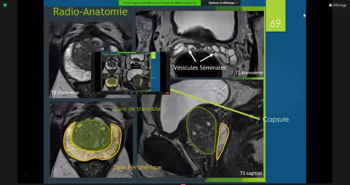 Radio-anatomie uro-pelvienne