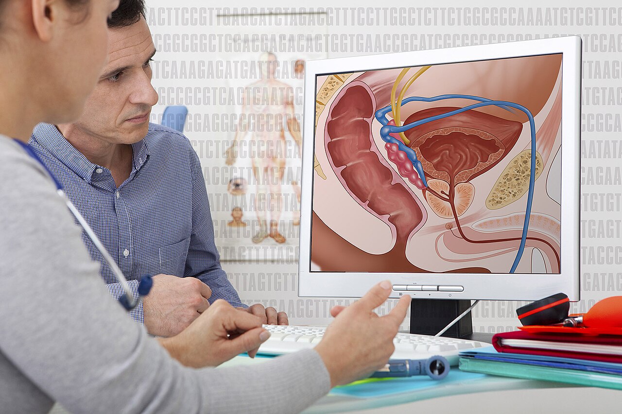 Recherché génétique et biomarqueurs prostatiques