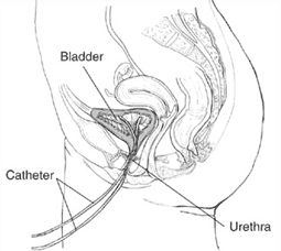 Bilan urodynamique — cystomanométrie