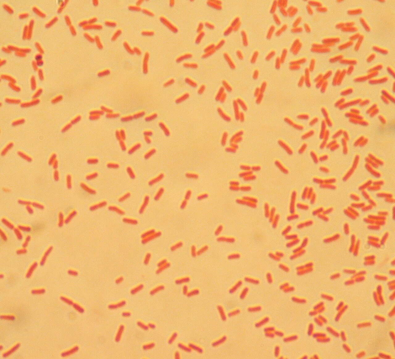 Escherichia coli — culture