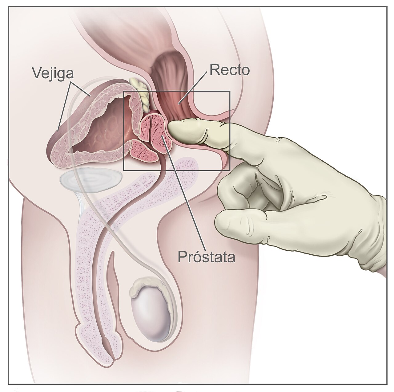 Toucher rectal