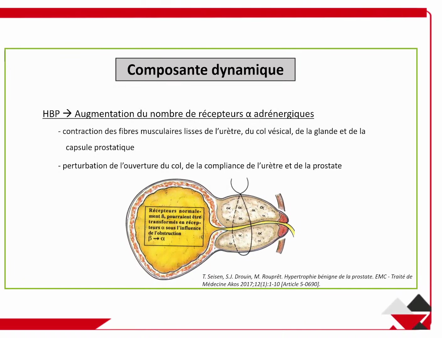 Comparatif des techniques chirurgicales