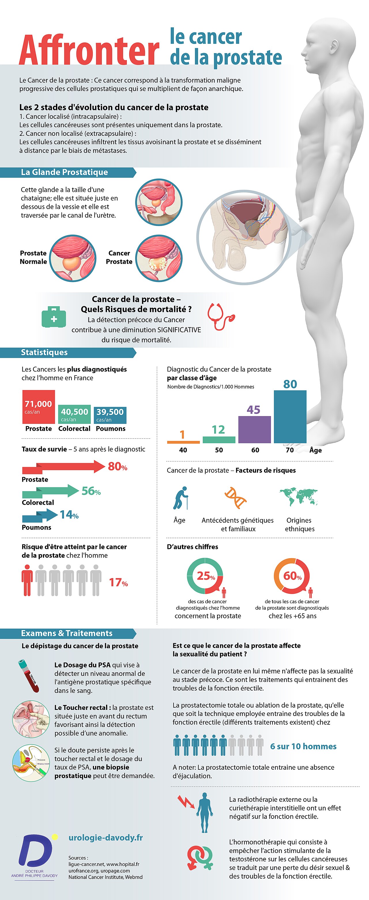 Statistiques du cancer de la prostate