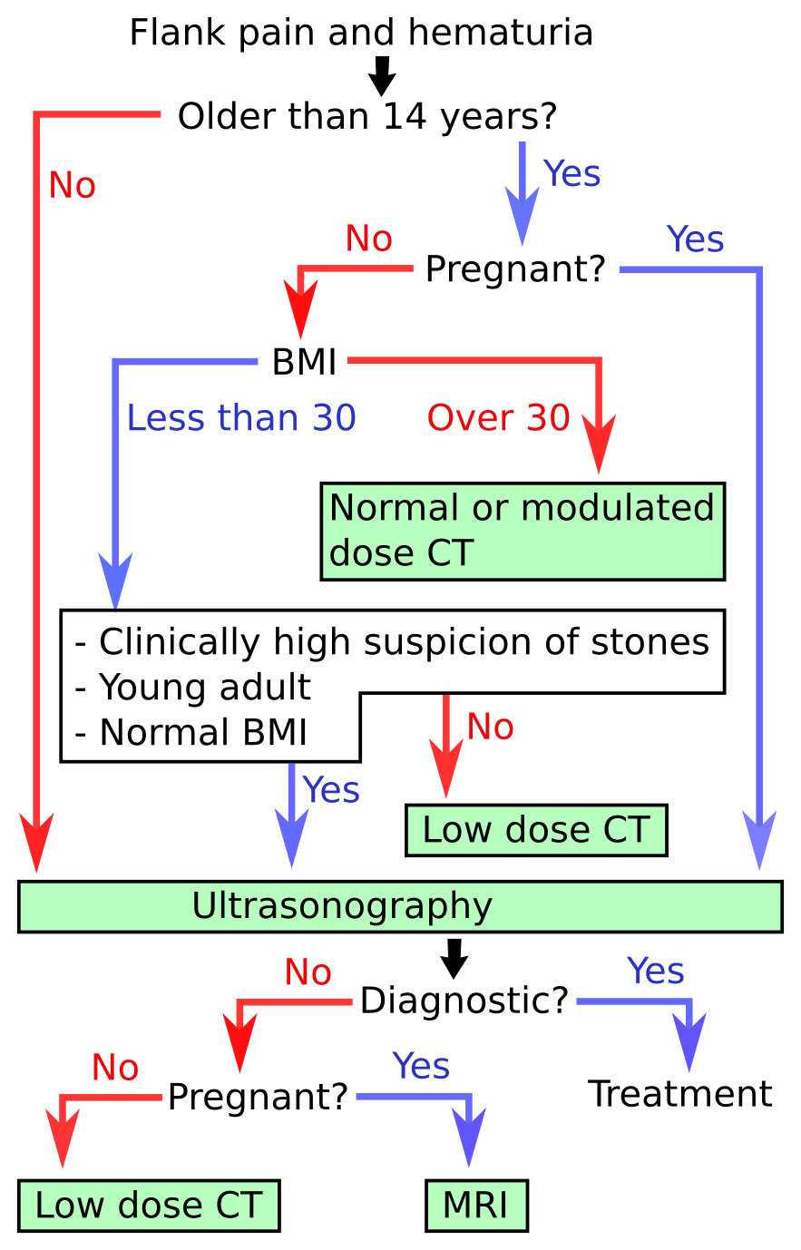 Algorithme diagnostiqué lithiase