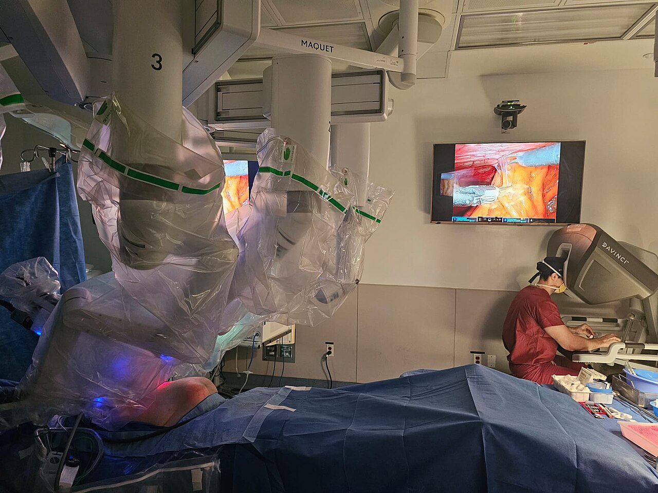 Chirurgien opérant avec assistance robotique