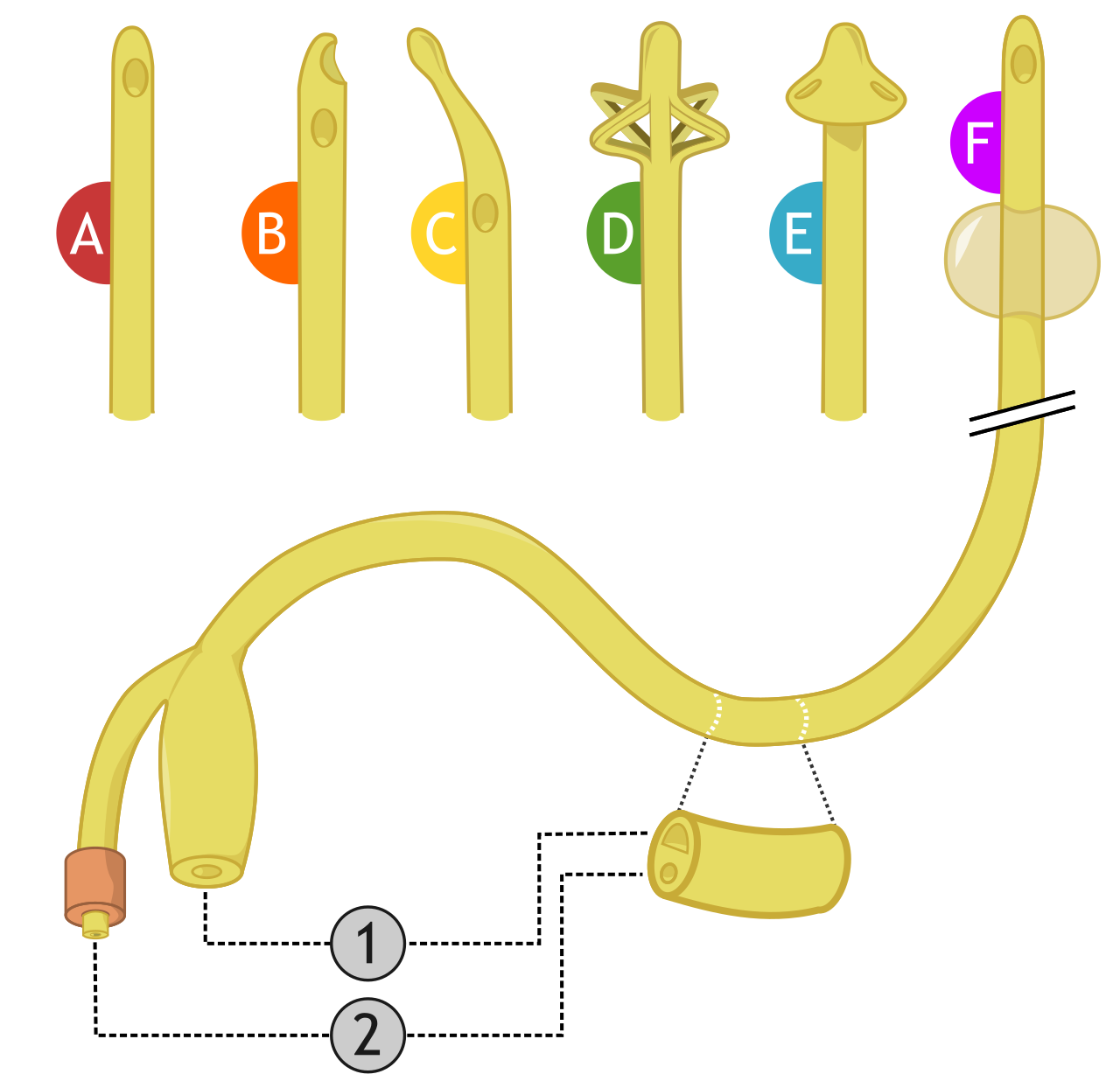 Types de sondes urinaires — sonde simple, Foley, béquillée, sus-pubienne