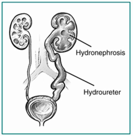 Uro-IRM