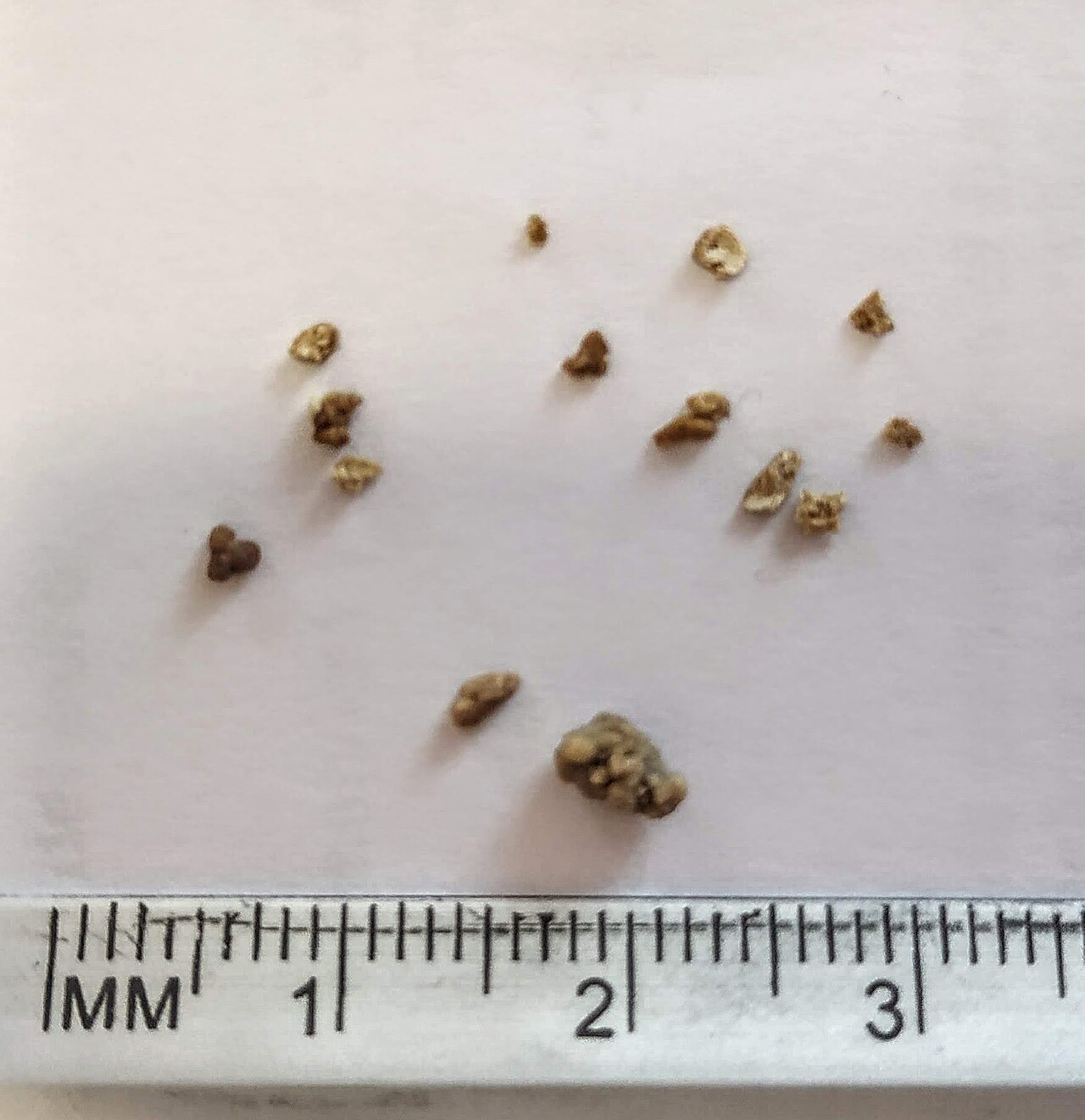 Fragments de calcul après lithotritie