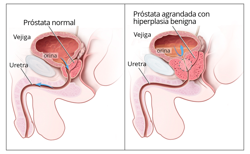 Appareil reproducteur et urinaire masculin — vue normale