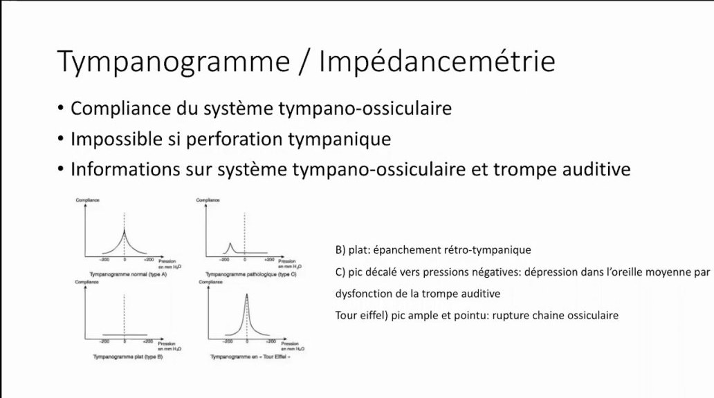 Audiométrie et Explorations Fonctionnelles