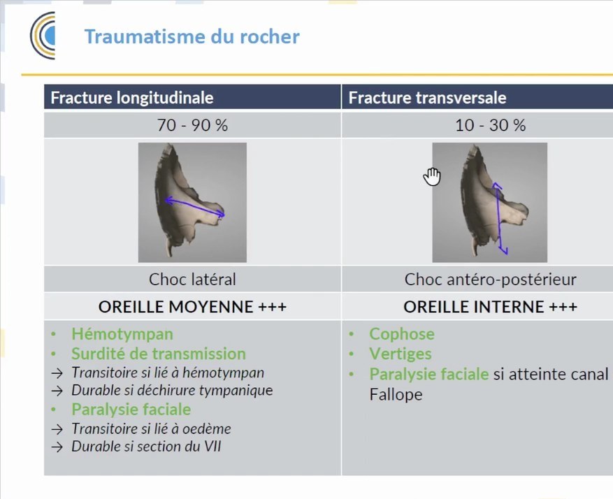 Imagerie ORL - TDM et IRM