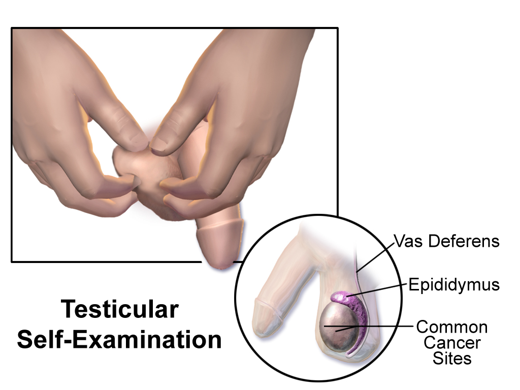 Auto-examen testiculaire