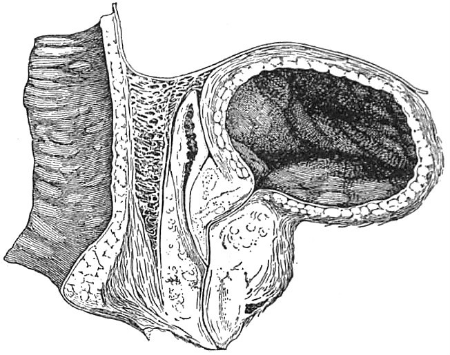 Coupe sagittale médiane — vessie, prostate, rectum