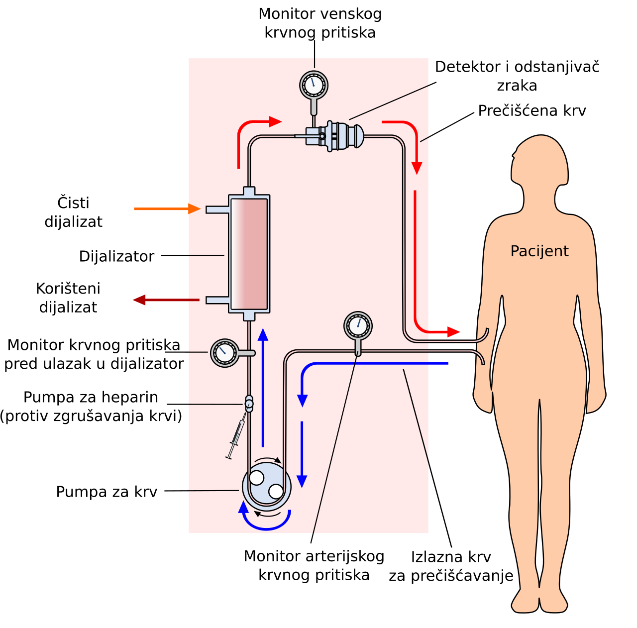 Circuit simplifié de circulation extracorporelle