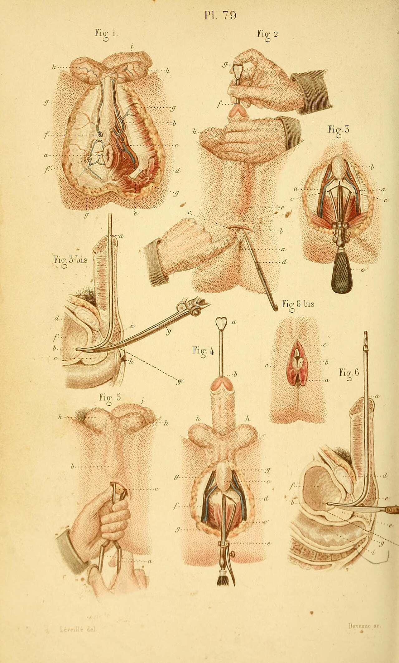 Anatomie chirurgicale du périnée