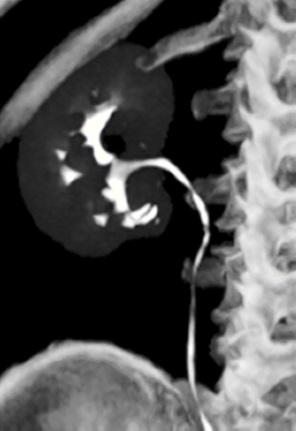 Uroscanner