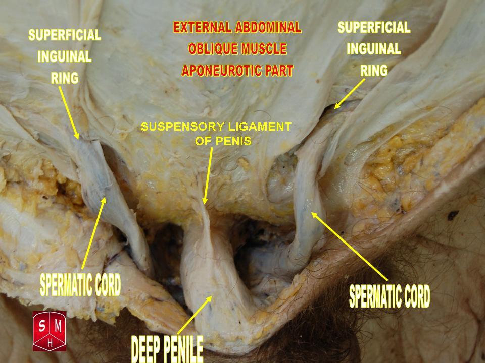 Anatomical preparation