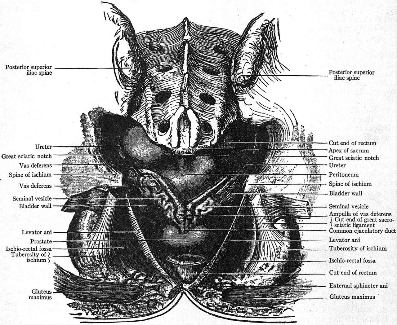 View of the base of the bladder prostate seminal vesicles an
