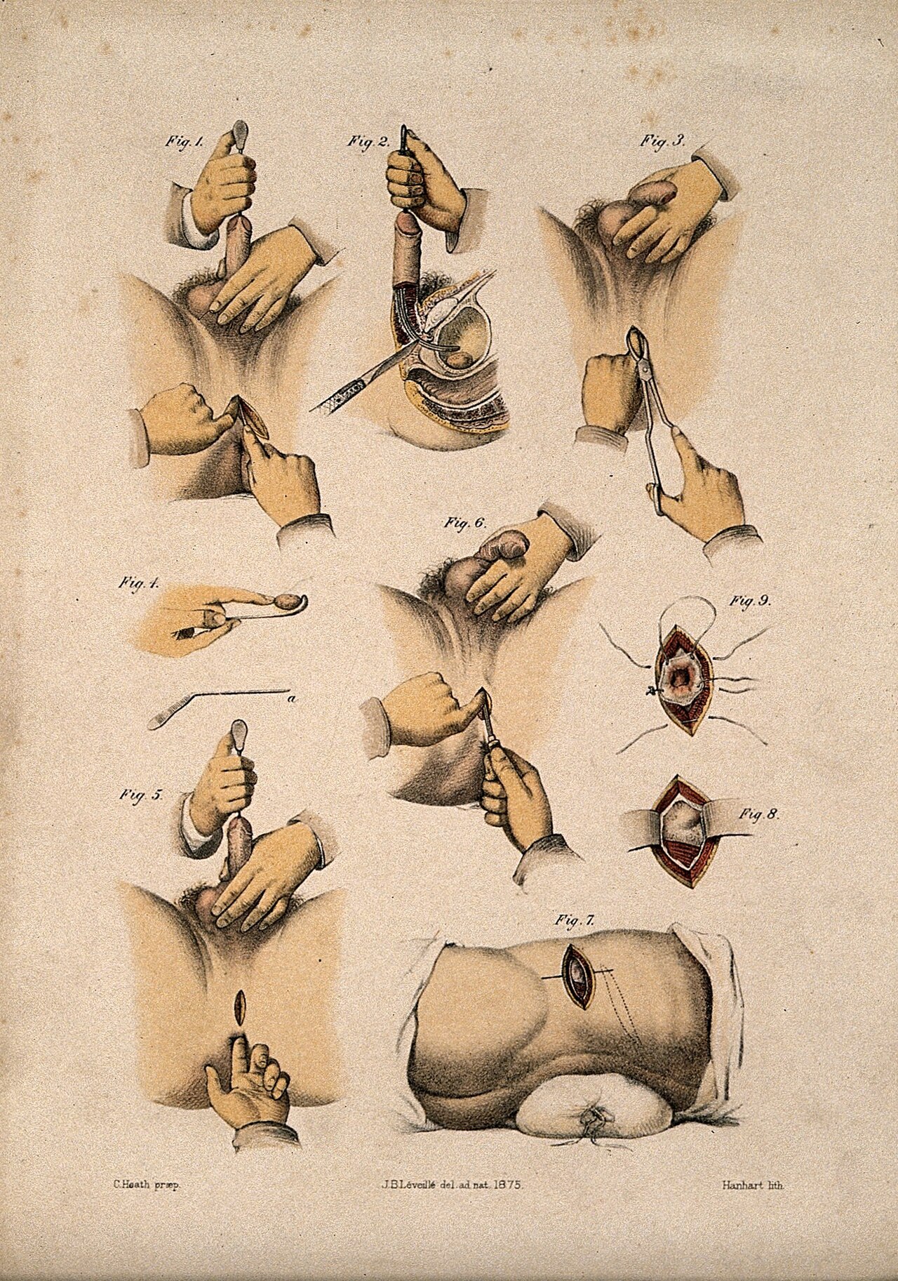 Nine diagrams illustrating cross sections through the male r