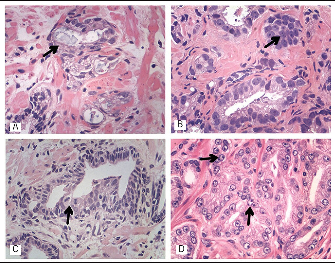Illustrative images of some morphological criteria for the d