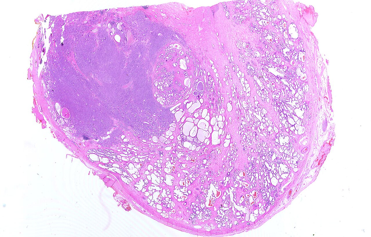 Whole slide of half a prostate scanned epson perfection 1670