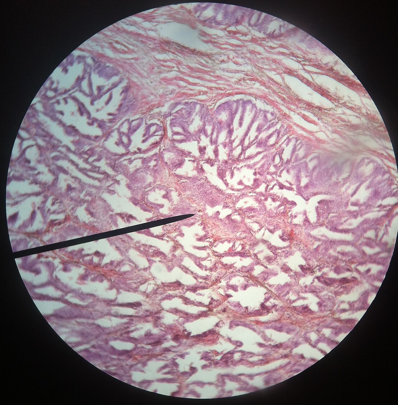 Prostate slide
