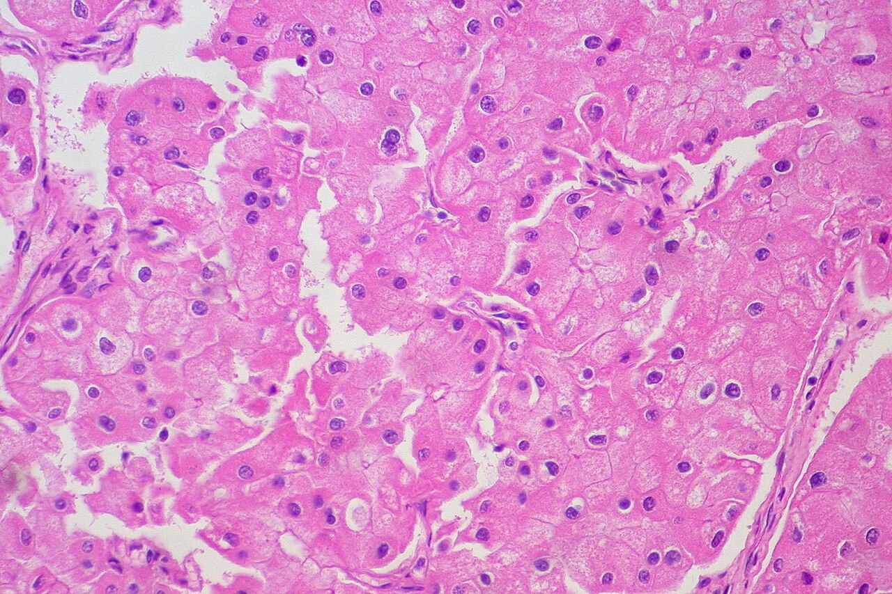From a slide study set pathological and histological images