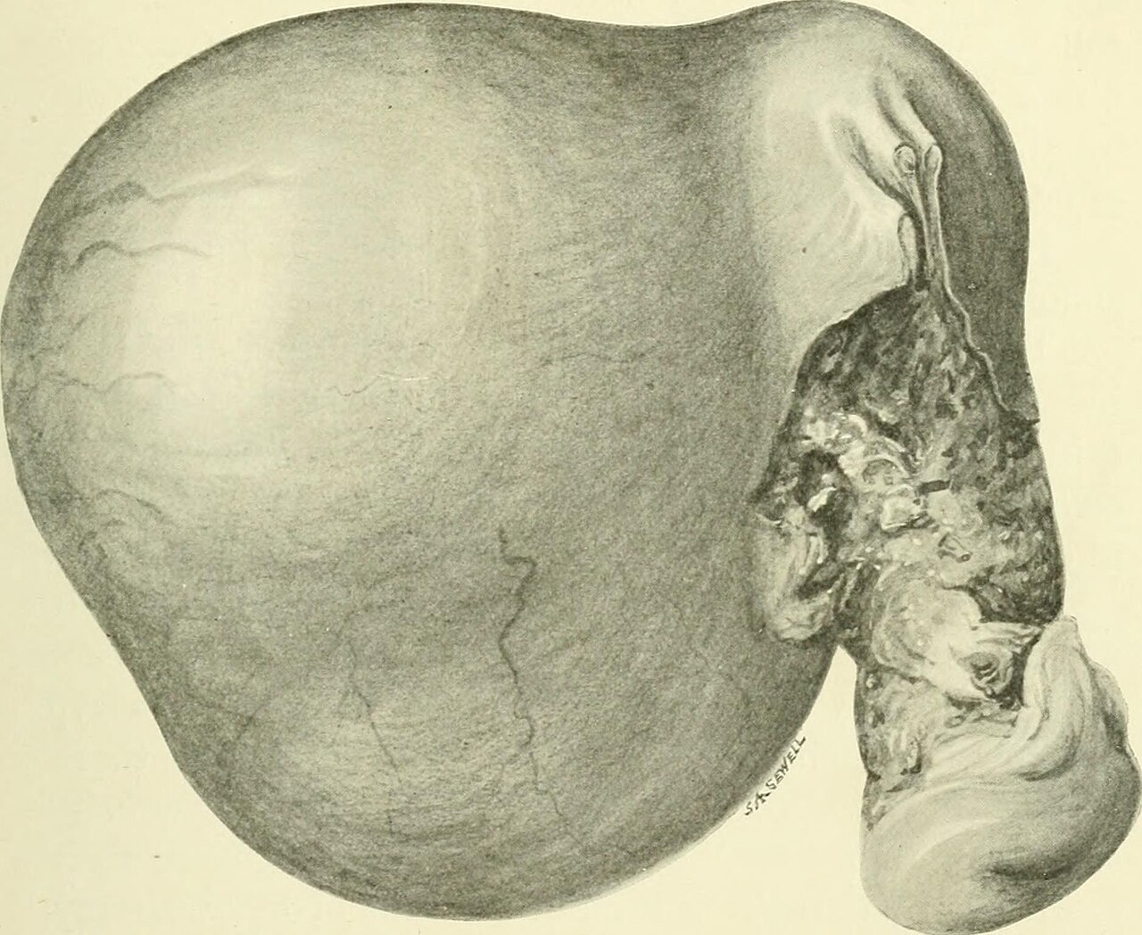 Identifier fibroidsalliedtu00lockuoft find matches title fib