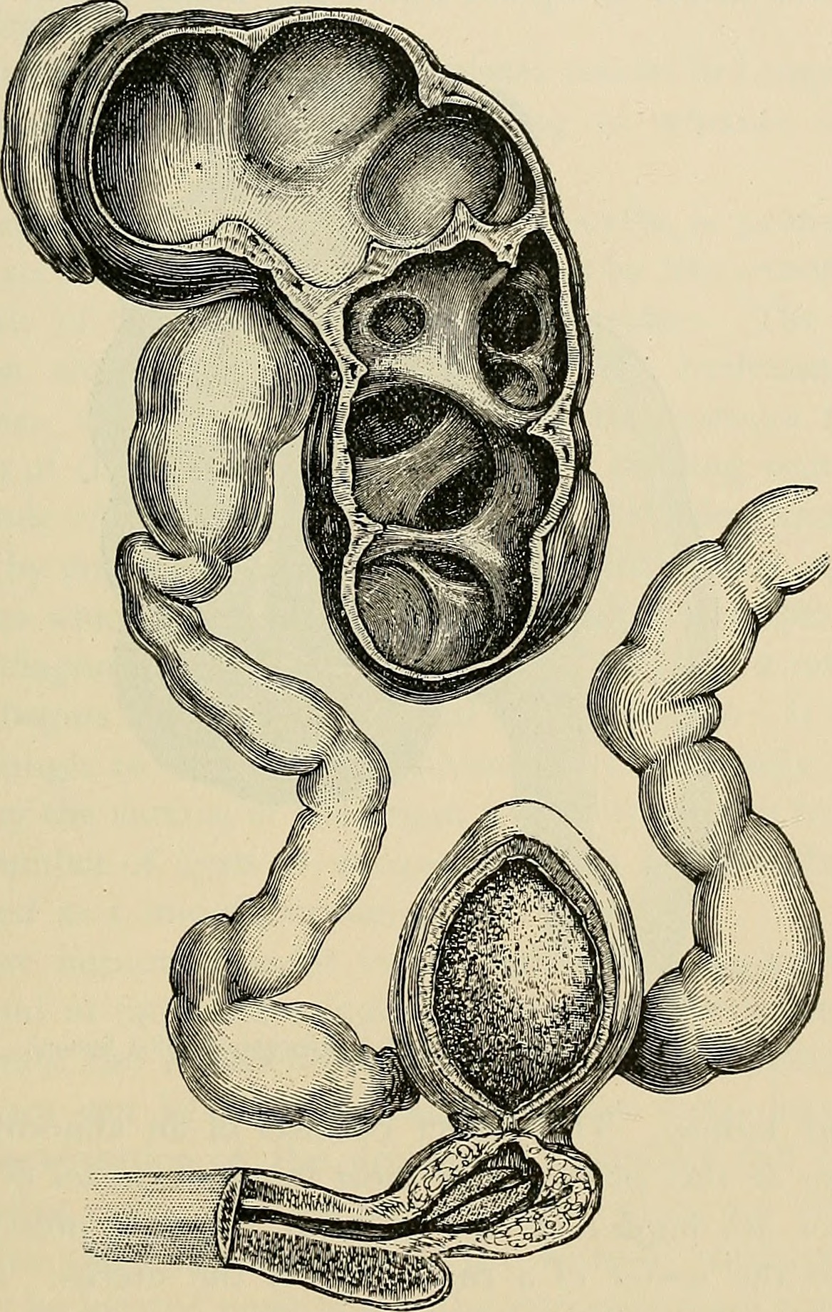 Identifier pathologysurgica1895senn find matches title the p