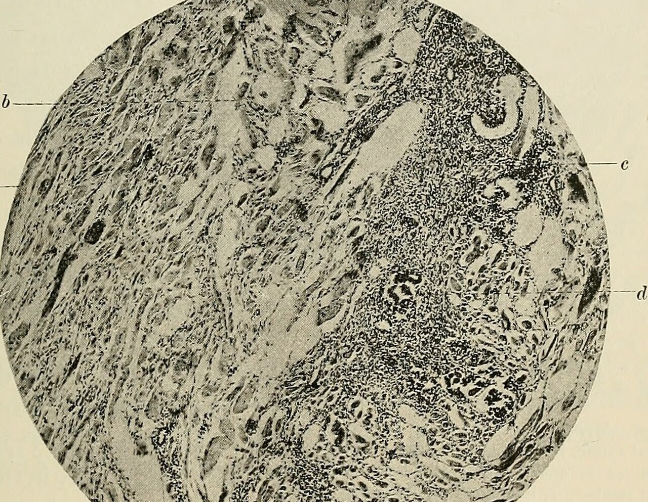 Identifier pathologysurgica1895senn find matches title the p