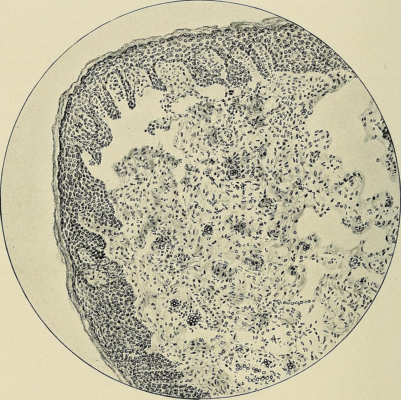 Identifier gynecologygrav2 find matches title gynecology yea