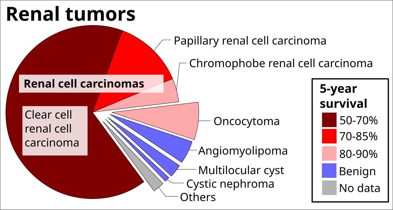 Edit renal tumors by relative incidence and prognosis refere