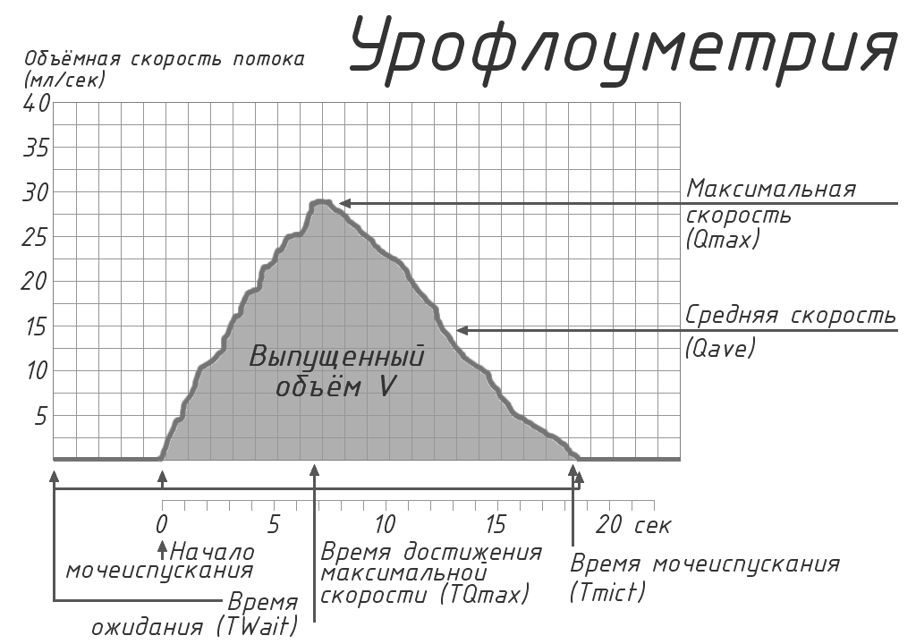 Uroflowmetry uroflow chart and the main quantitative indicat