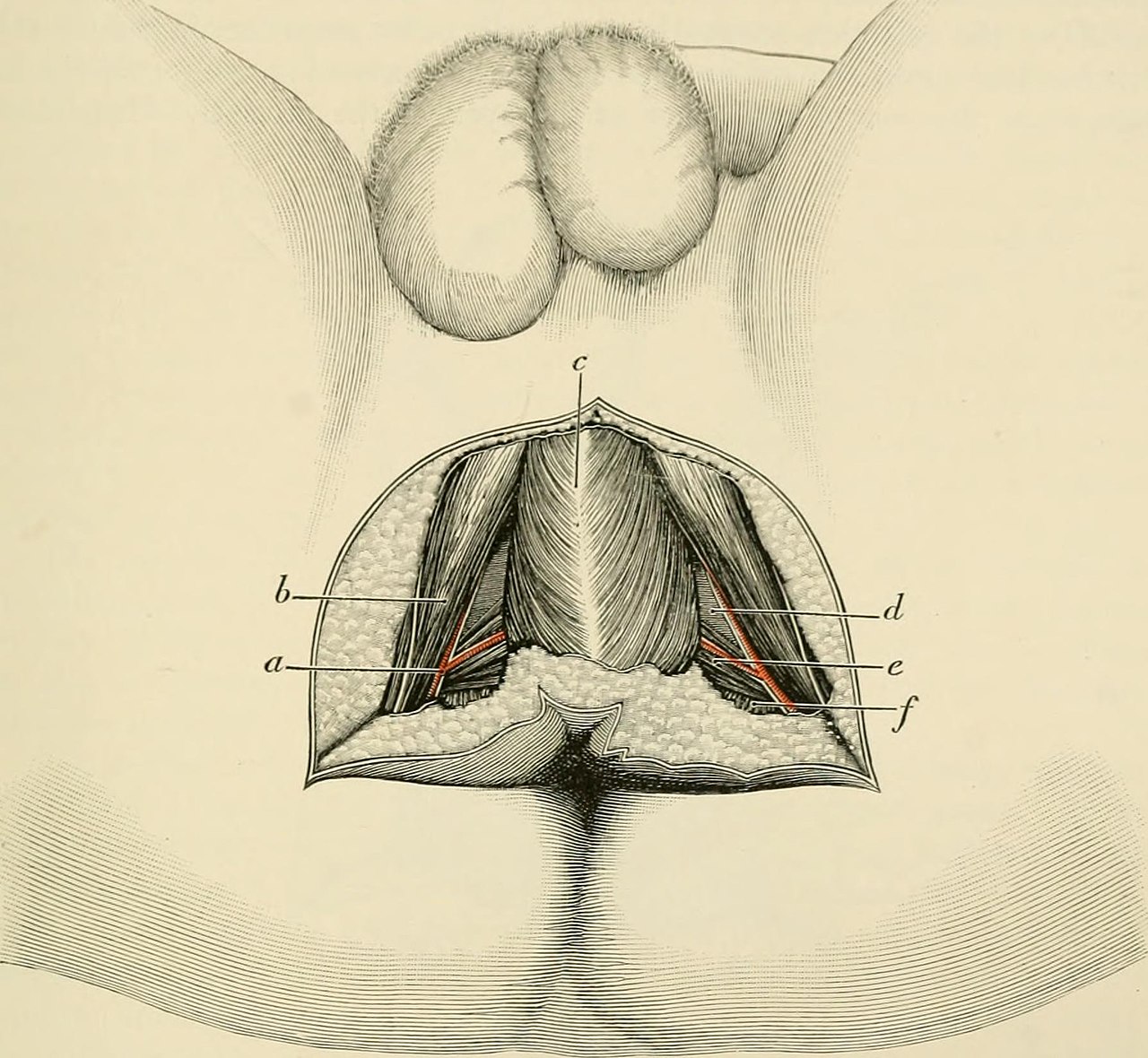Superficial surgical anatomy of perineum identifier operativ