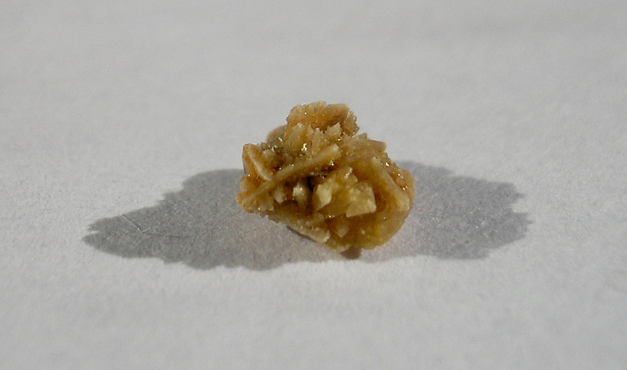 A kidney stone yet unidentified type author supposed calcium