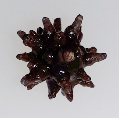 A 1 cm big spiculated kidney stone resembling a morning star