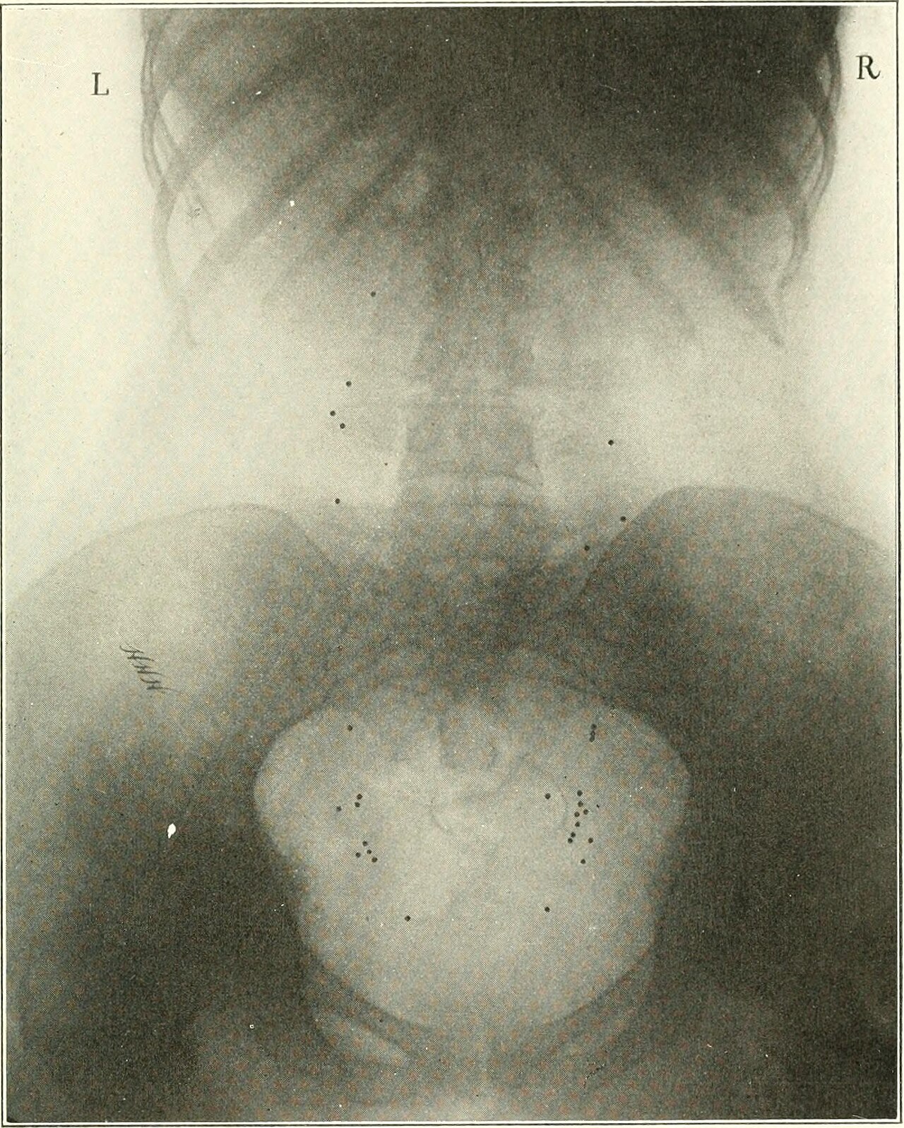 Identifier diseasesofkidney01kell find matches title disease