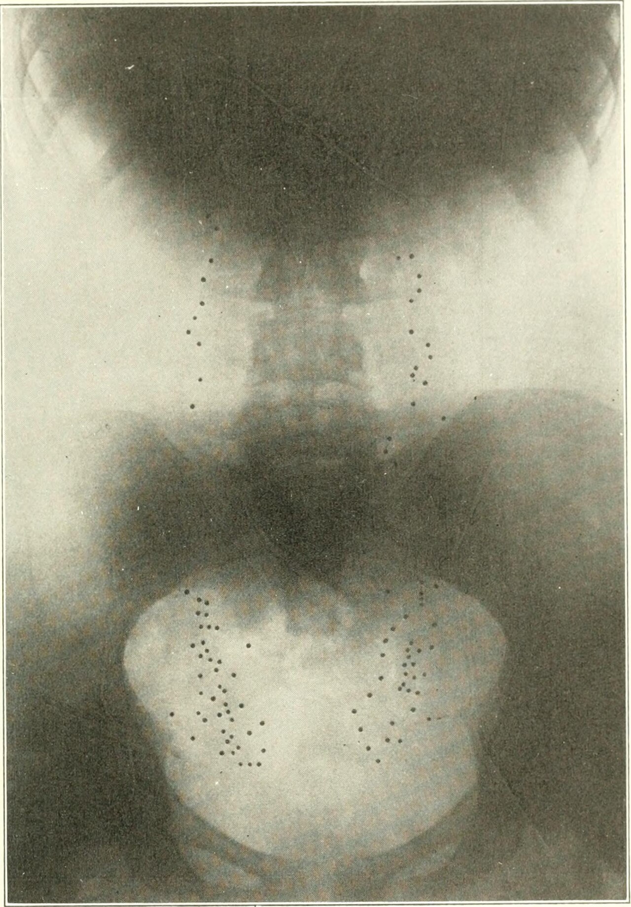 Identifier diseasesofkidney01kell find matches title disease
