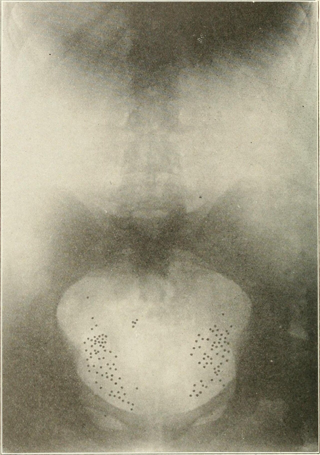 Identifier diseasesofkidney01kell find matches title disease