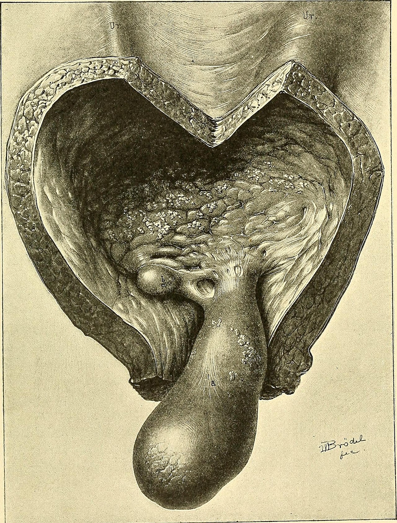 Identifier operativegynecol001kell find matches title operat