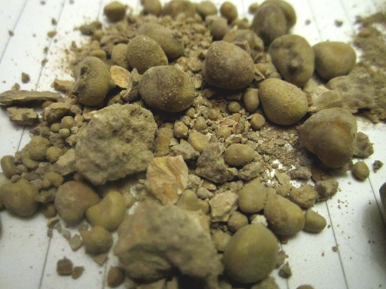Kidney stones