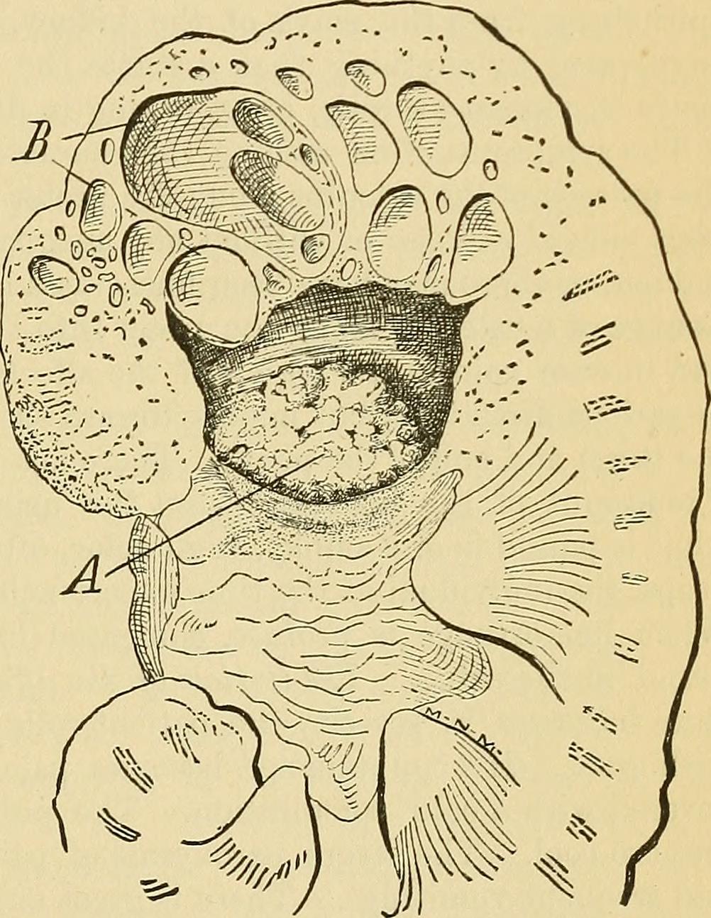 Renal calculi identifier textbookofpracti1885loom find match