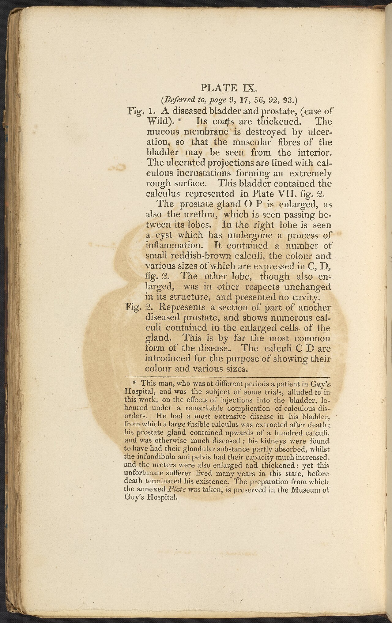 Alexander marcet 1770 1822 was a genevan physician who speci
