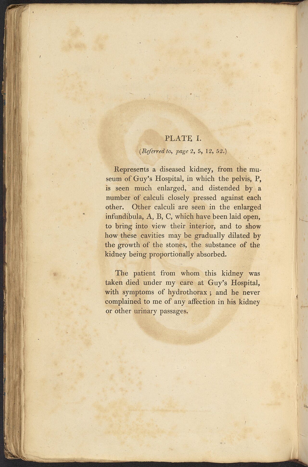 Alexander marcet 1770 1822 was a genevan physician who speci