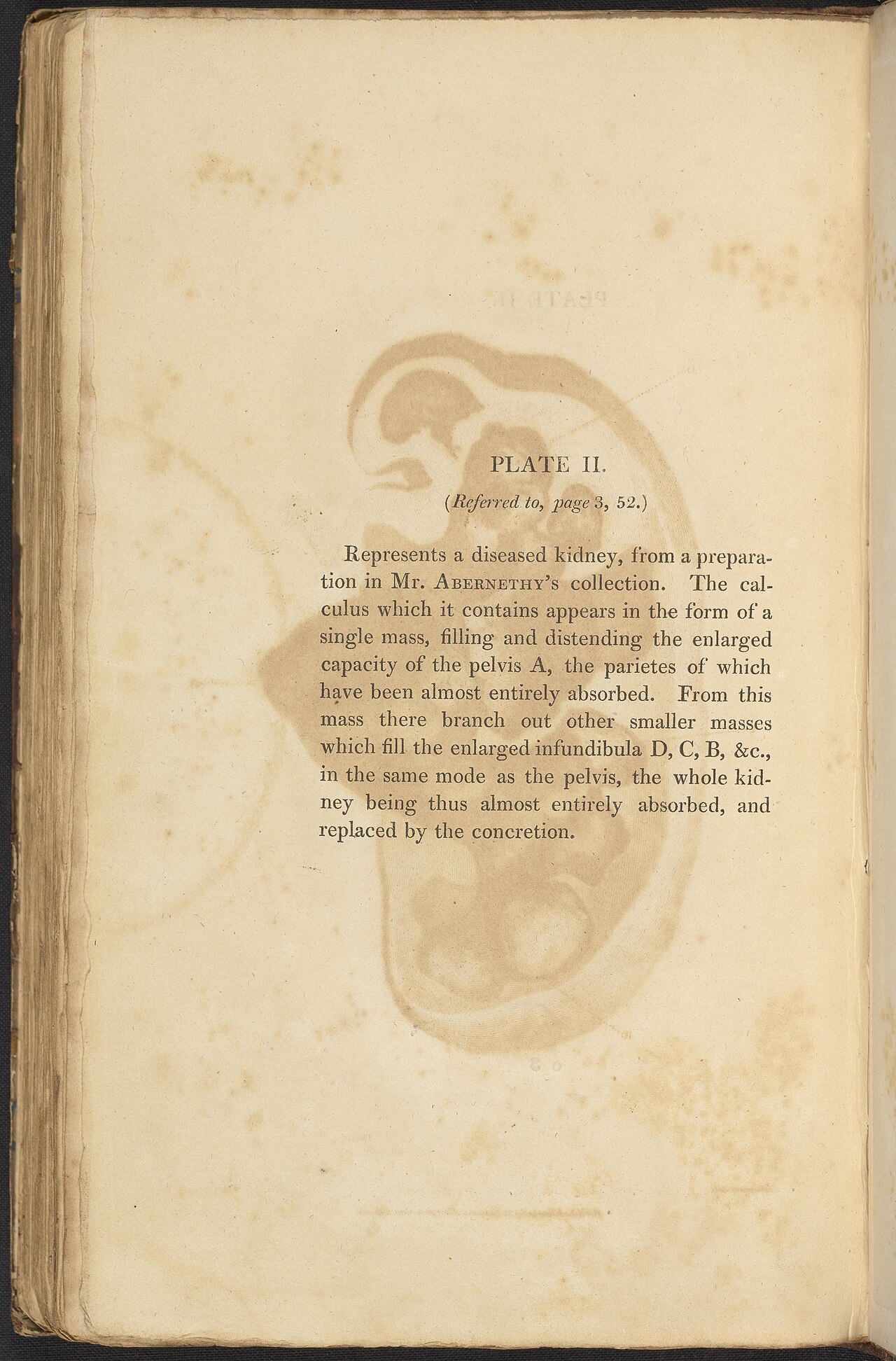 Alexander marcet 1770 1822 was a genevan physician who speci