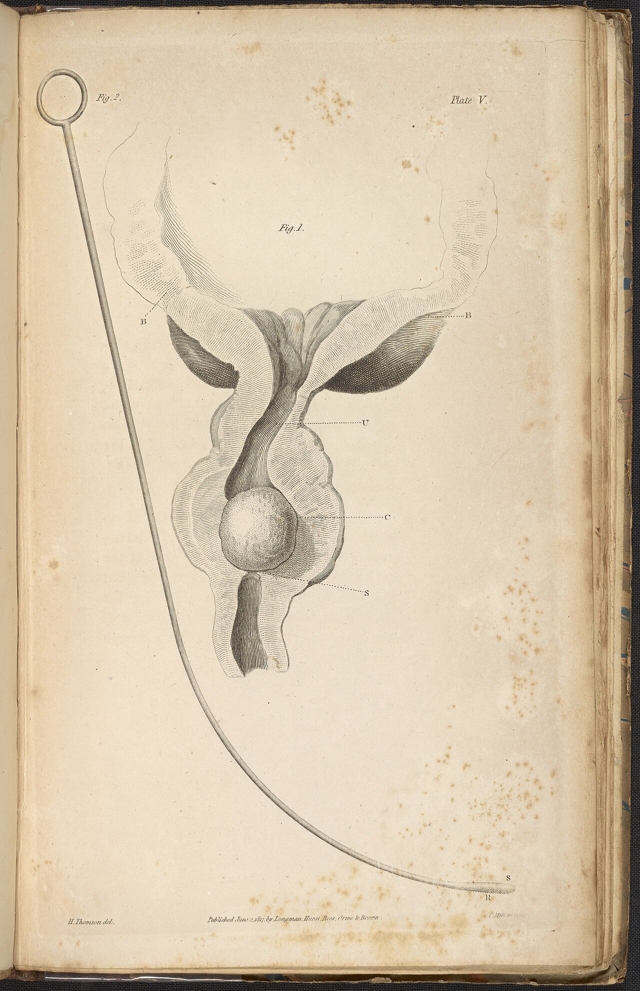 Alexander marcet 1770 1822 was a genevan physician who speci